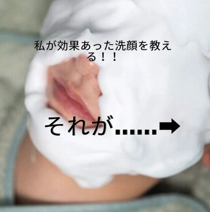 アネトス マイルド フェイシャル クレンザー/Anetos/洗顔フォームを使ったクチコミ(2枚目)