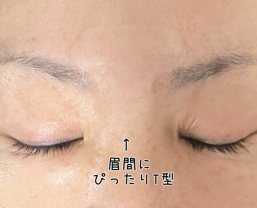 レチアールエヌ Tパッチ/ACROPASS/シートマスク・パックを使ったクチコミ(5枚目)