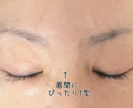 レチアールエヌ Tパッチ/ACROPASS/シートマスク・パックを使ったクチコミ(5枚目)