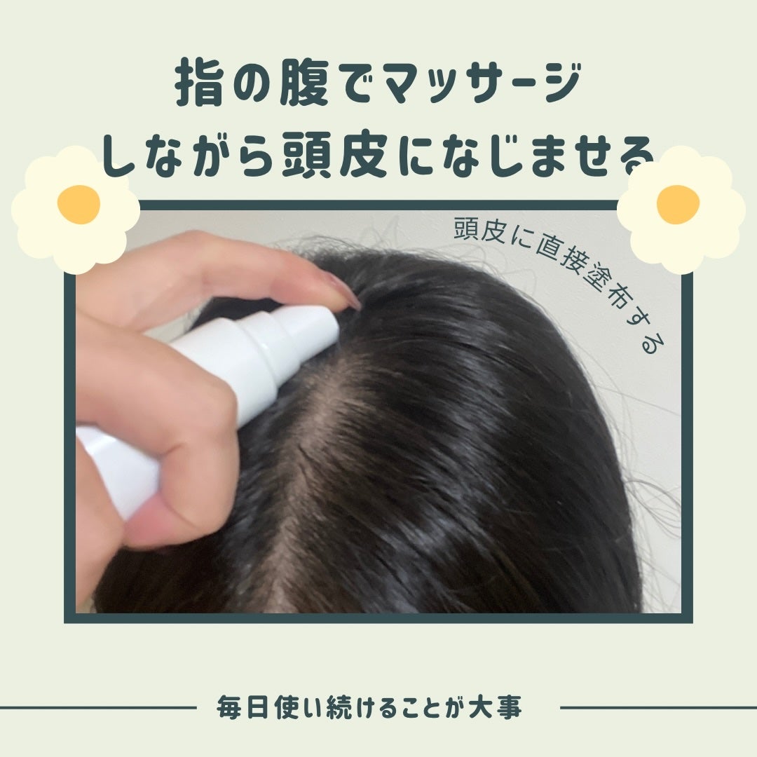 あやこ @フォロバ100 on LIPS 「30代に入ってから、髪の悩み一気に増えた気がする…。産後の脱毛..」(4枚目)
