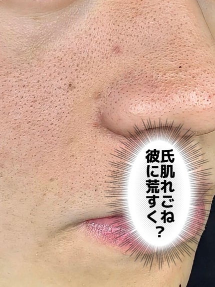 アネトス マイルド フェイシャル クレンザー/Anetos/洗顔フォームを使ったクチコミ(3枚目)