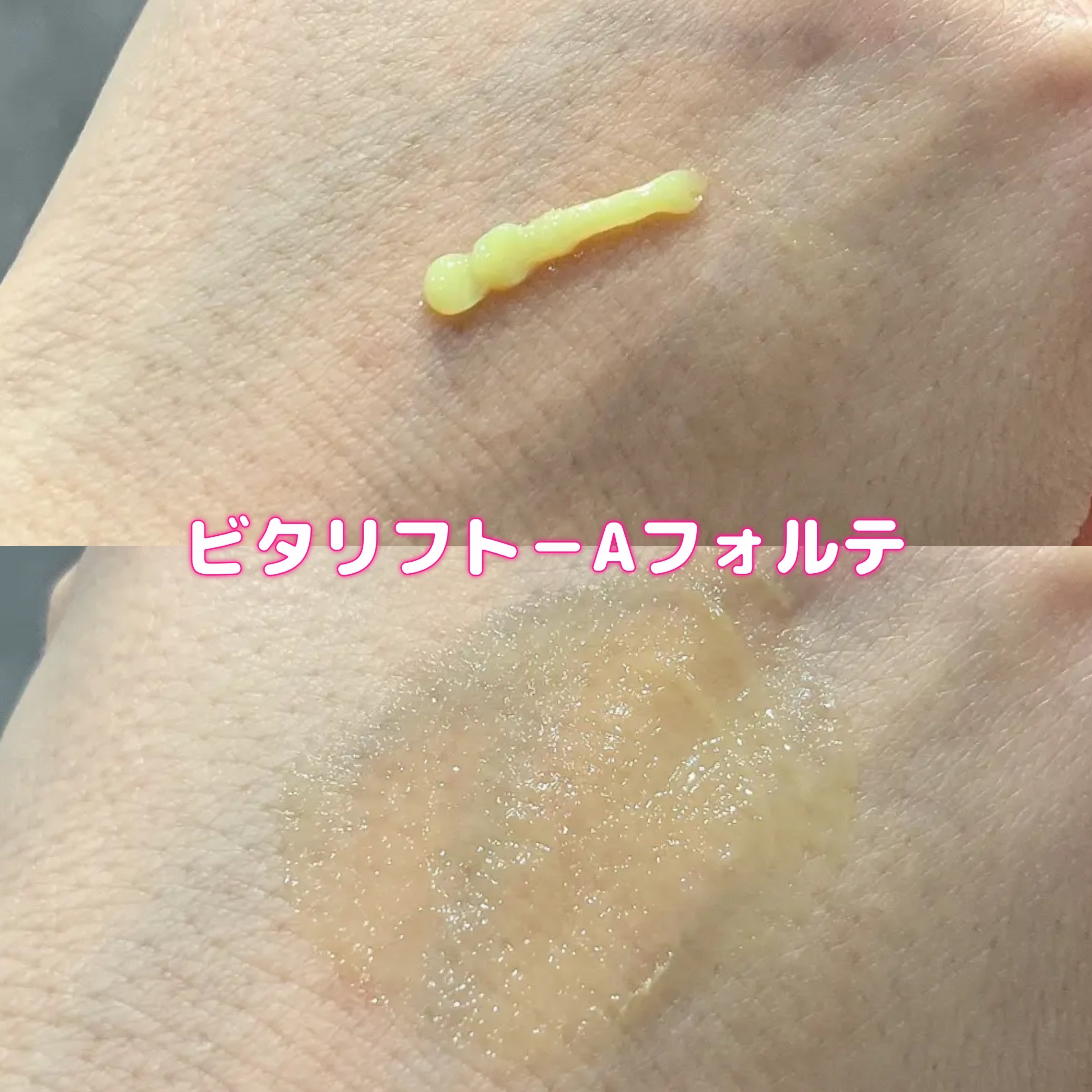 VITALIFT A forte/Dr.Different/フェイスクリームを使ったクチコミ（3枚目）
