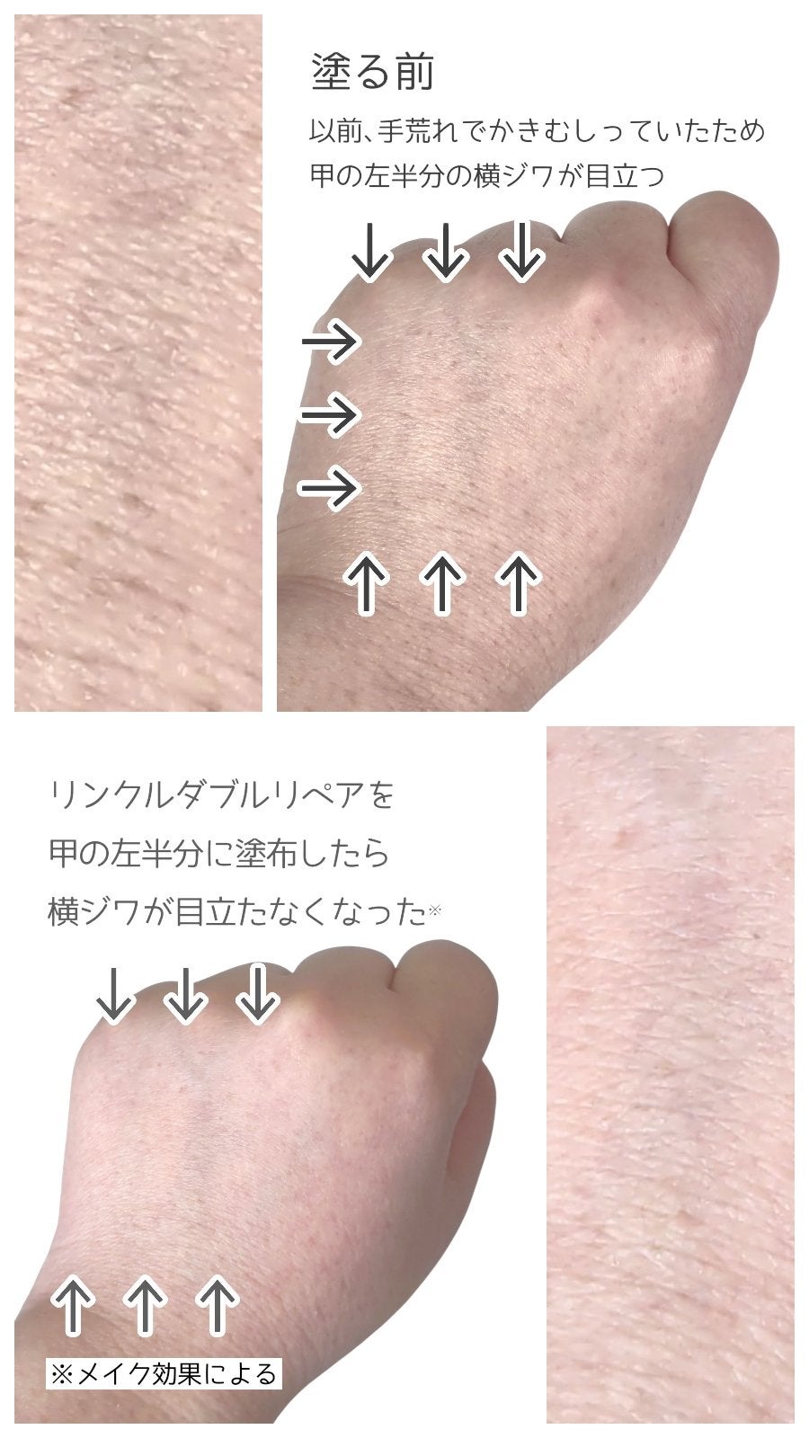 リンクル ダブル リペア/ONE BY KOSE/美容液を使ったクチコミ(7枚目)