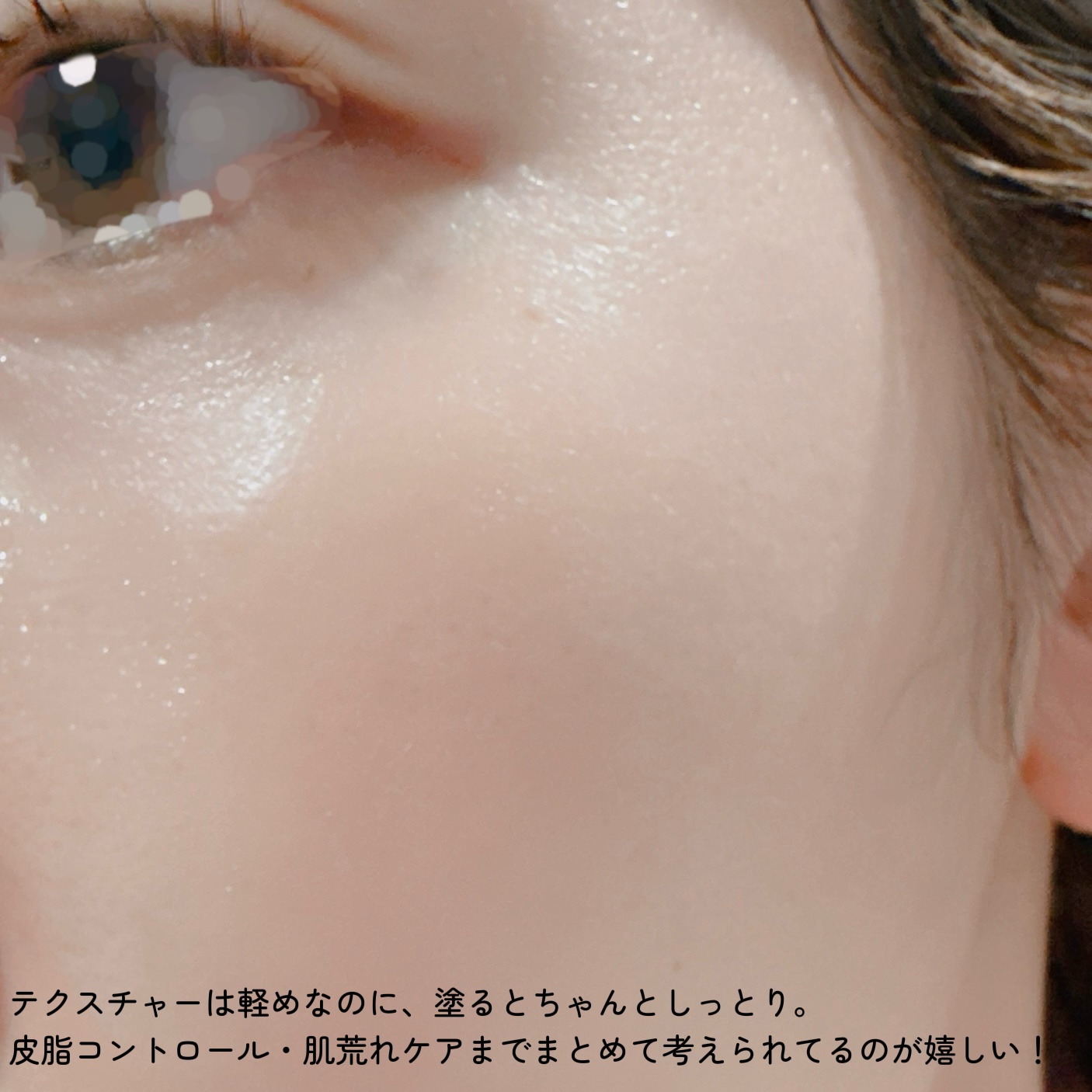 ベルプリモ ACリペアクリーム/BELPRIMO/フェイスクリームを使ったクチコミ（3枚目）