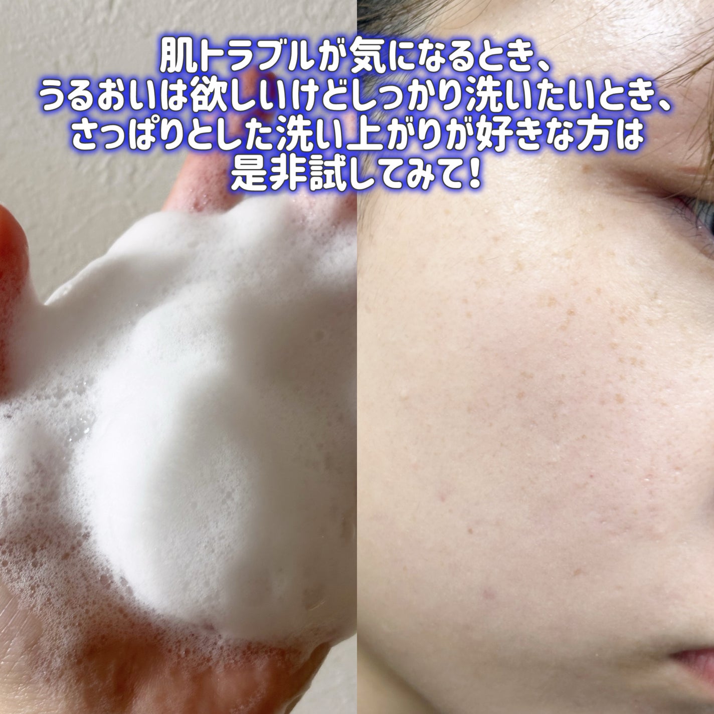 ベルプリモ ACジェルクレンザー/BELPRIMO/洗顔フォームを使ったクチコミ(4枚目)