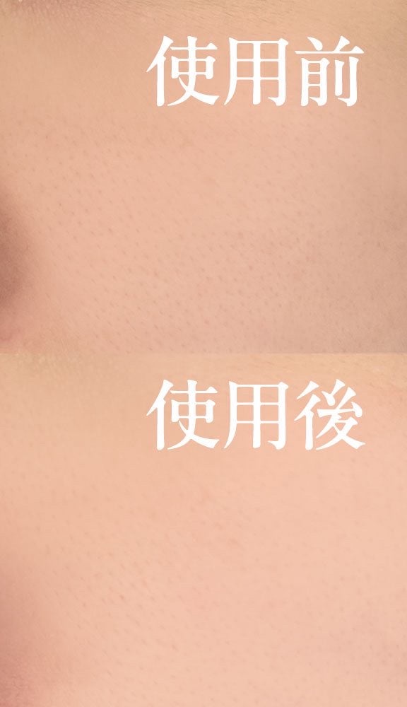 PDRN ヒアルロン酸 ミントマイクロバブルセラム/VT/美容液を使ったクチコミ（3枚目）