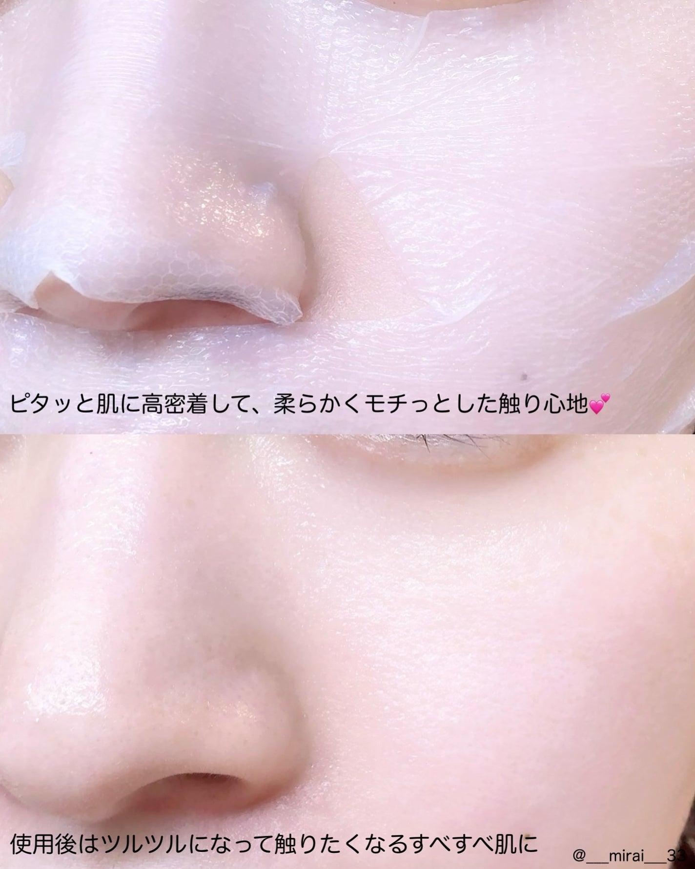 トラブルパッチマスク/EIOM/その他スキンケアを使ったクチコミ(4枚目)