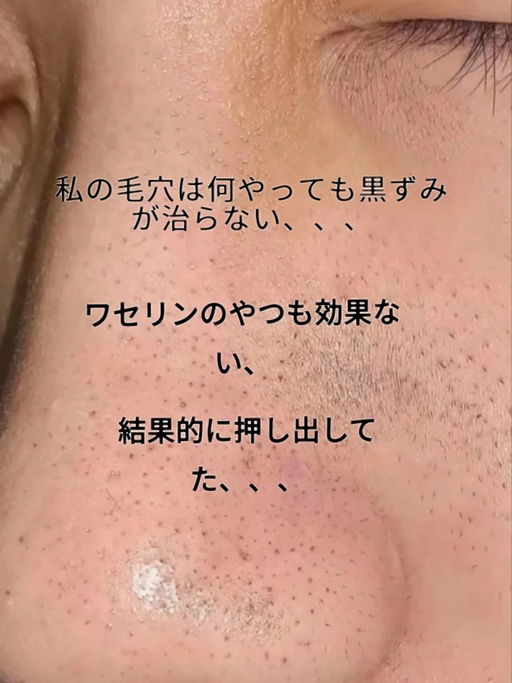 アネトス マイルド フェイシャル クレンザー/Anetos/洗顔フォームを使ったクチコミ(4枚目)