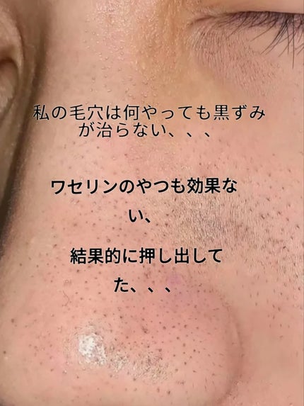 アネトス マイルド フェイシャル クレンザー/Anetos/洗顔フォームを使ったクチコミ(4枚目)