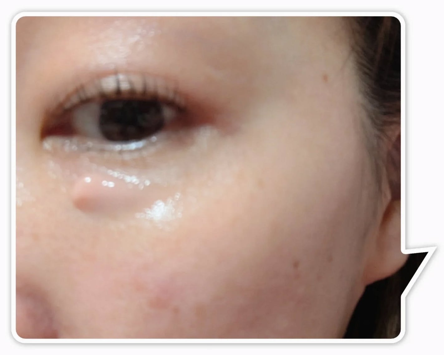 薬用アイクリームCL/ヴィオテラス/アイケア・アイクリームを使ったクチコミ(5枚目)