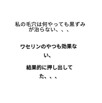 アネトス マイルド フェイシャル クレンザー/Anetos/洗顔フォームを使ったクチコミ(4枚目)