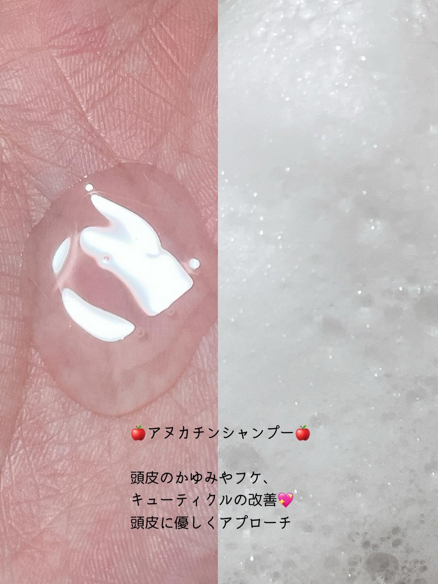 モエブ アヌカチン シャンプー/トリートメント/moev/市販シャンプーを使ったクチコミ(3枚目)