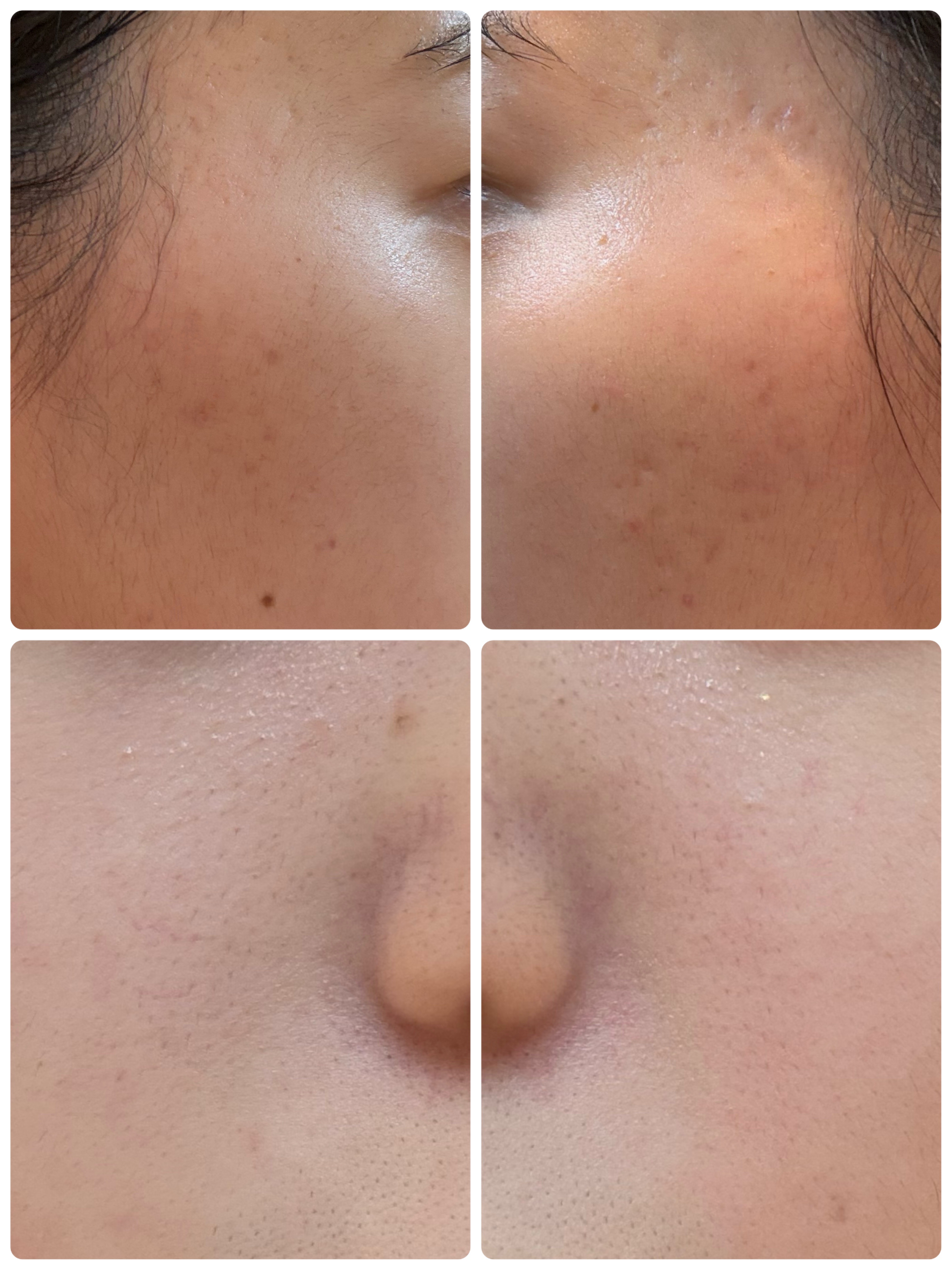 GLAM UP炭酸泡クレイマスク/GLAM UP/洗い流すパック・マスクを使ったクチコミ（2枚目）