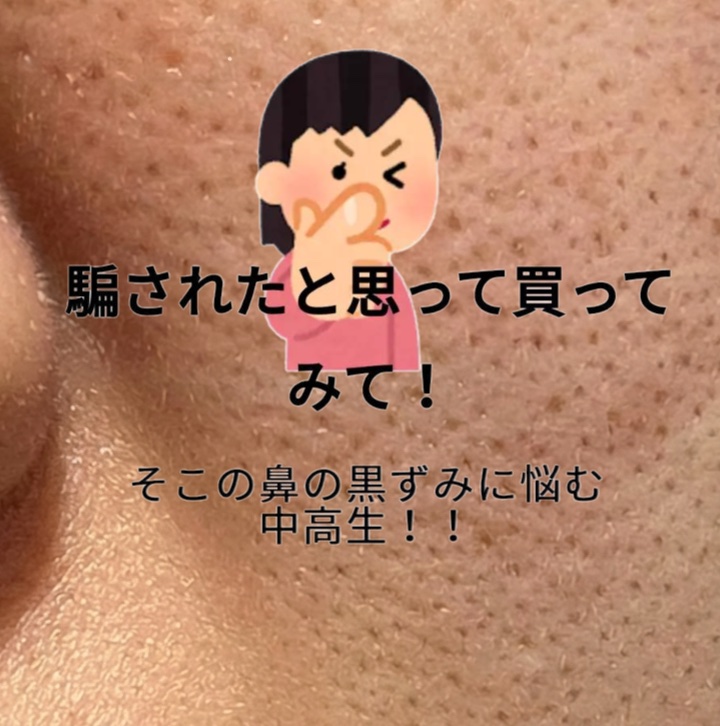 アネトス マイルド フェイシャル クレンザー/Anetos/洗顔フォームを使ったクチコミ（1枚目）