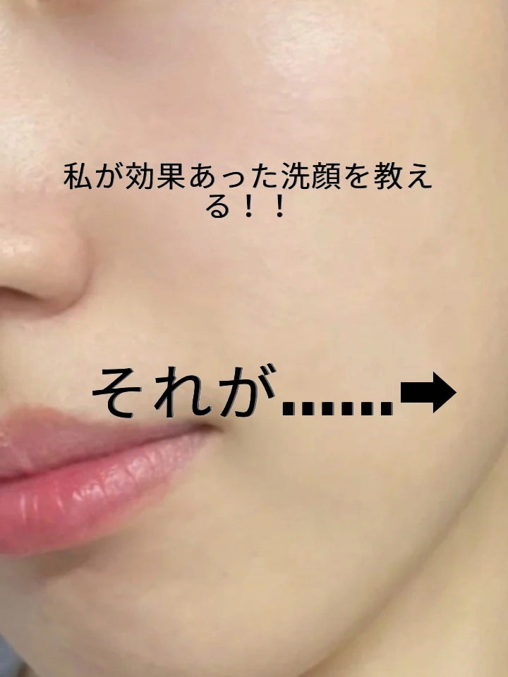 アネトス マイルド フェイシャル クレンザー/Anetos/洗顔フォームを使ったクチコミ(2枚目)