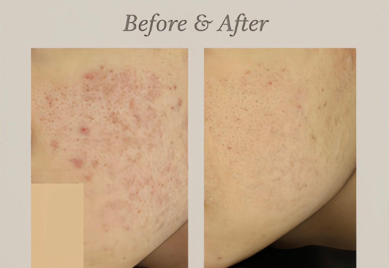 Lumiin_clinic_jp on LIPS 「もし気になるお肌のことがあれば、公式LINEを追加していただく..」(2枚目)