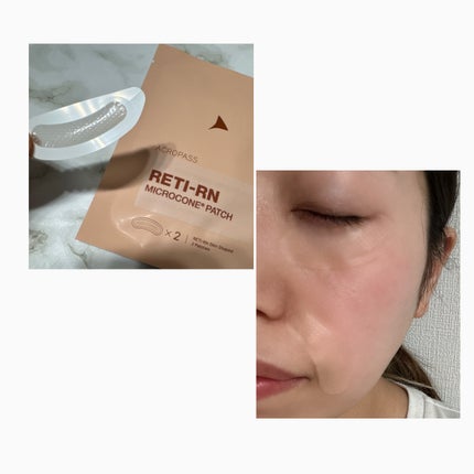 レチアールエヌ スリムパッチ/ACROPASS/シートマスク・パックを使ったクチコミ(5枚目)