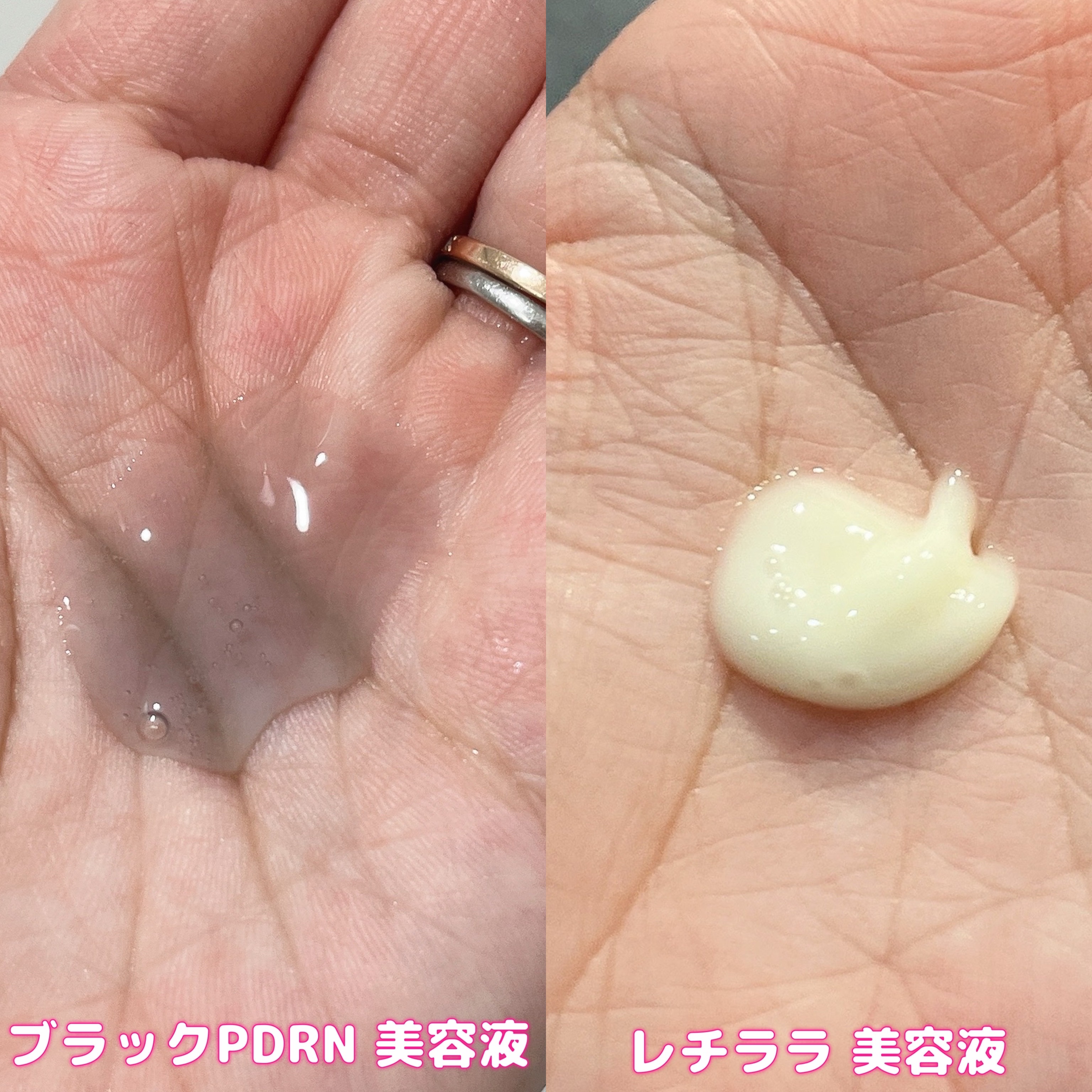 ブラックPDRN 美容液/ネイチャーリパブリック/美容液を使ったクチコミ（3枚目）