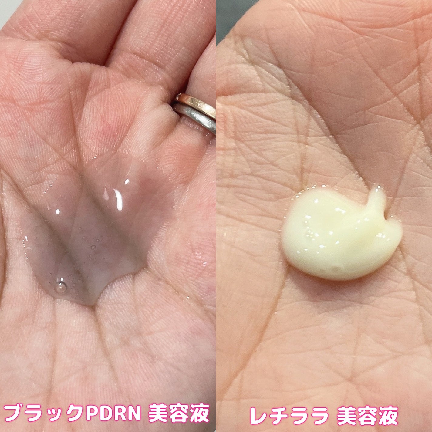 ブラックPDRN 美容液/ネイチャーリパブリック/美容液を使ったクチコミ(3枚目)