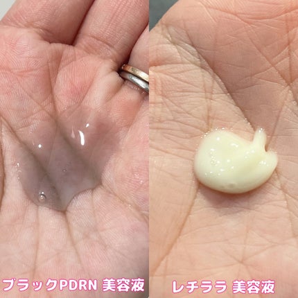 ブラックPDRN 美容液/ネイチャーリパブリック/美容液を使ったクチコミ(3枚目)