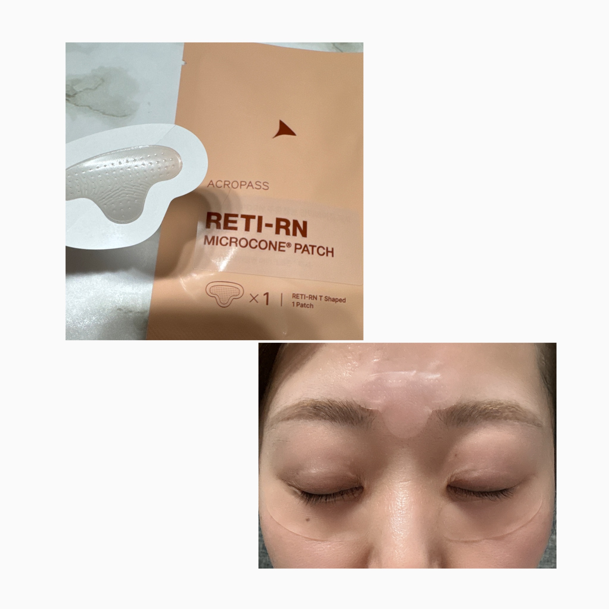 レチアールエヌ スリムパッチ/ACROPASS/シートマスク・パックを使ったクチコミ（3枚目）