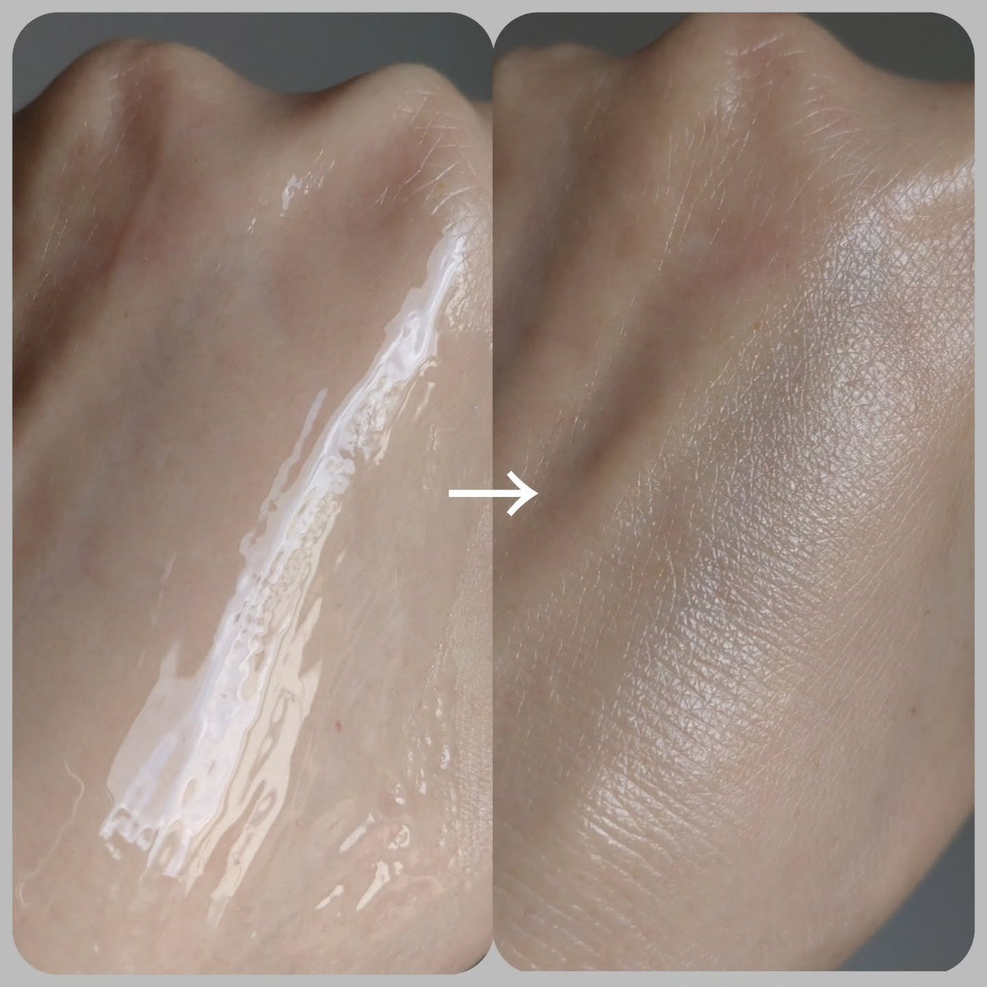 ピンクトーニング™︎ディープインショットアンプル/CNP Laboratory/美容液を使ったクチコミ(7枚目)