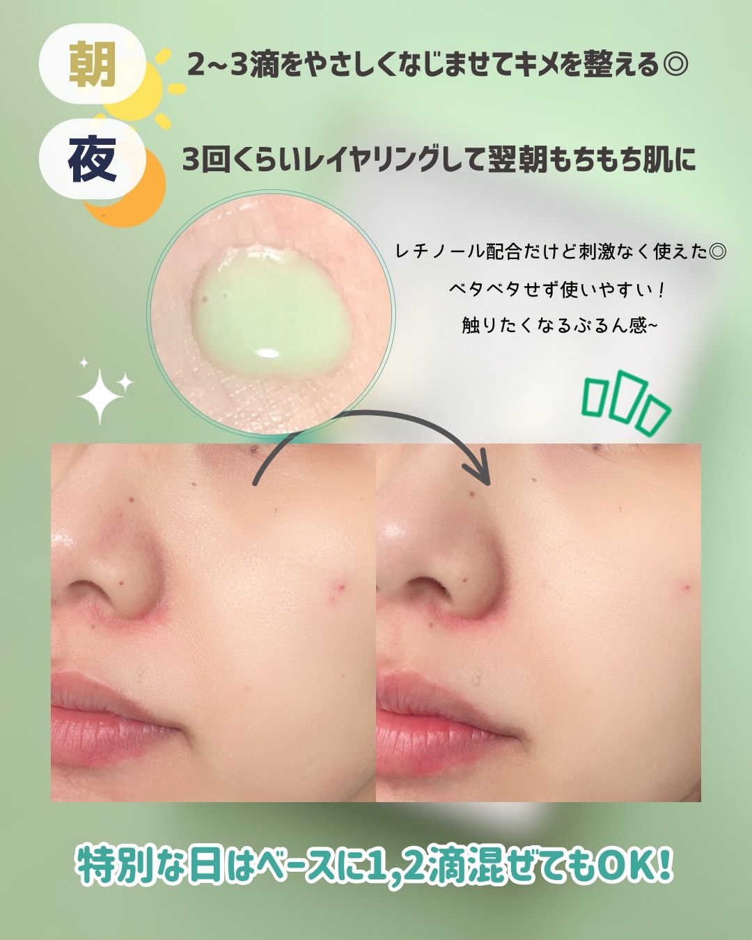 ReDRNエクソソームアンプル/Dr.nineteen/美容液を使ったクチコミ（3枚目）