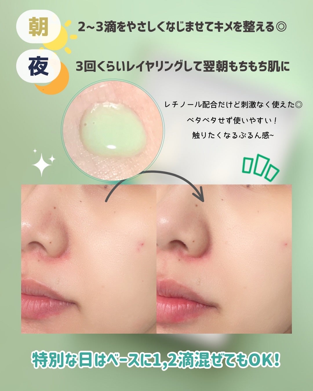 ReDRNエクソソームアンプル/Dr.nineteen/美容液を使ったクチコミ(3枚目)