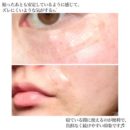 レチアールエヌ スリムパッチ/ACROPASS/シートマスク・パックを使ったクチコミ(5枚目)