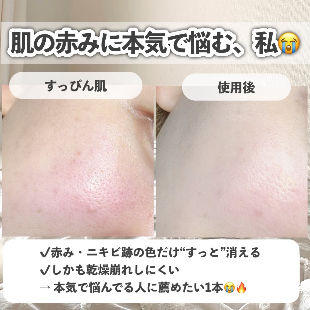 泡洗顔 セラムモイスト/ビフェスタ/泡洗顔を使ったクチコミ（3枚目）