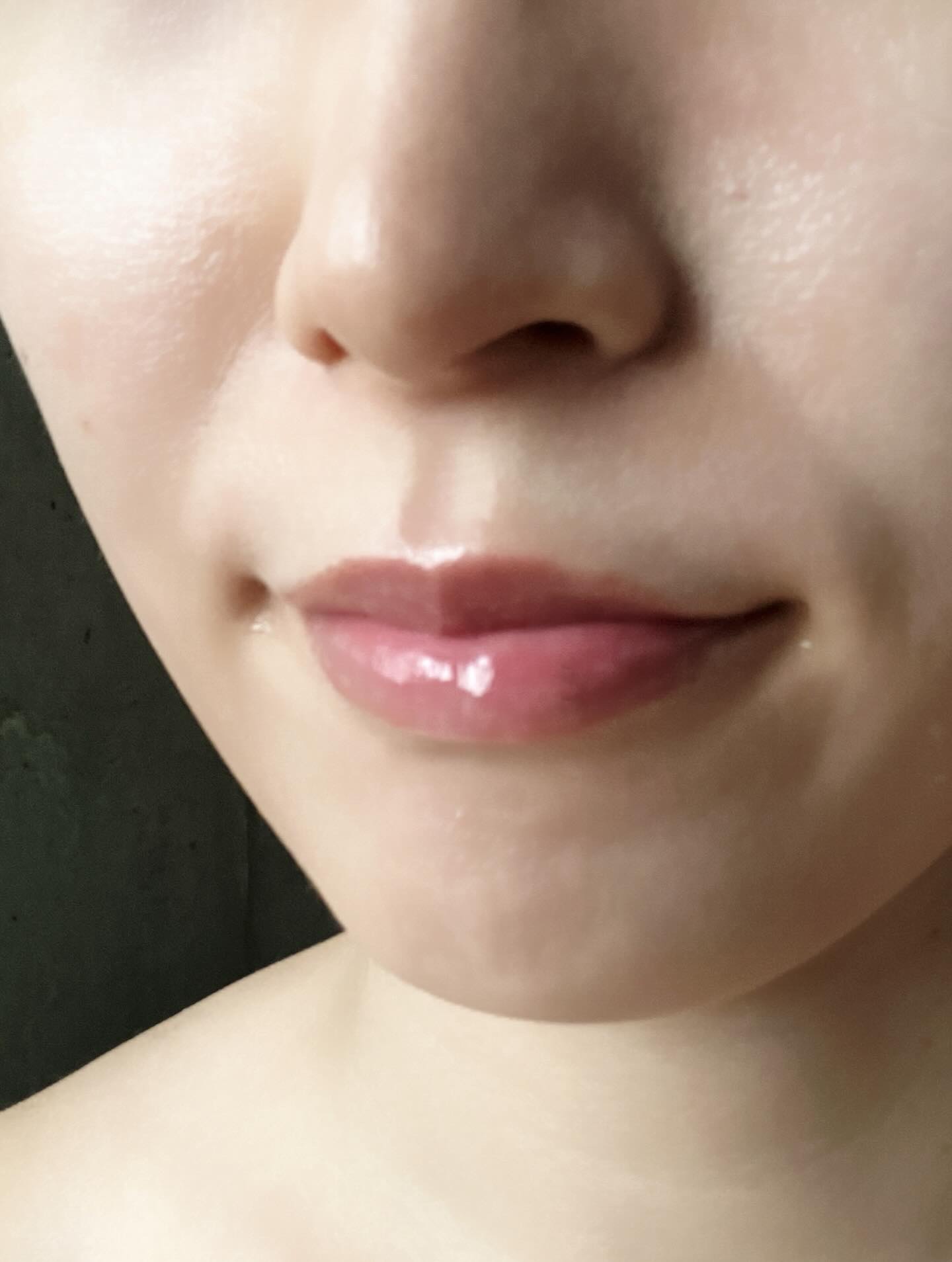 リップケア バーム/キュレル/リップバームを使ったクチコミ（3枚目）