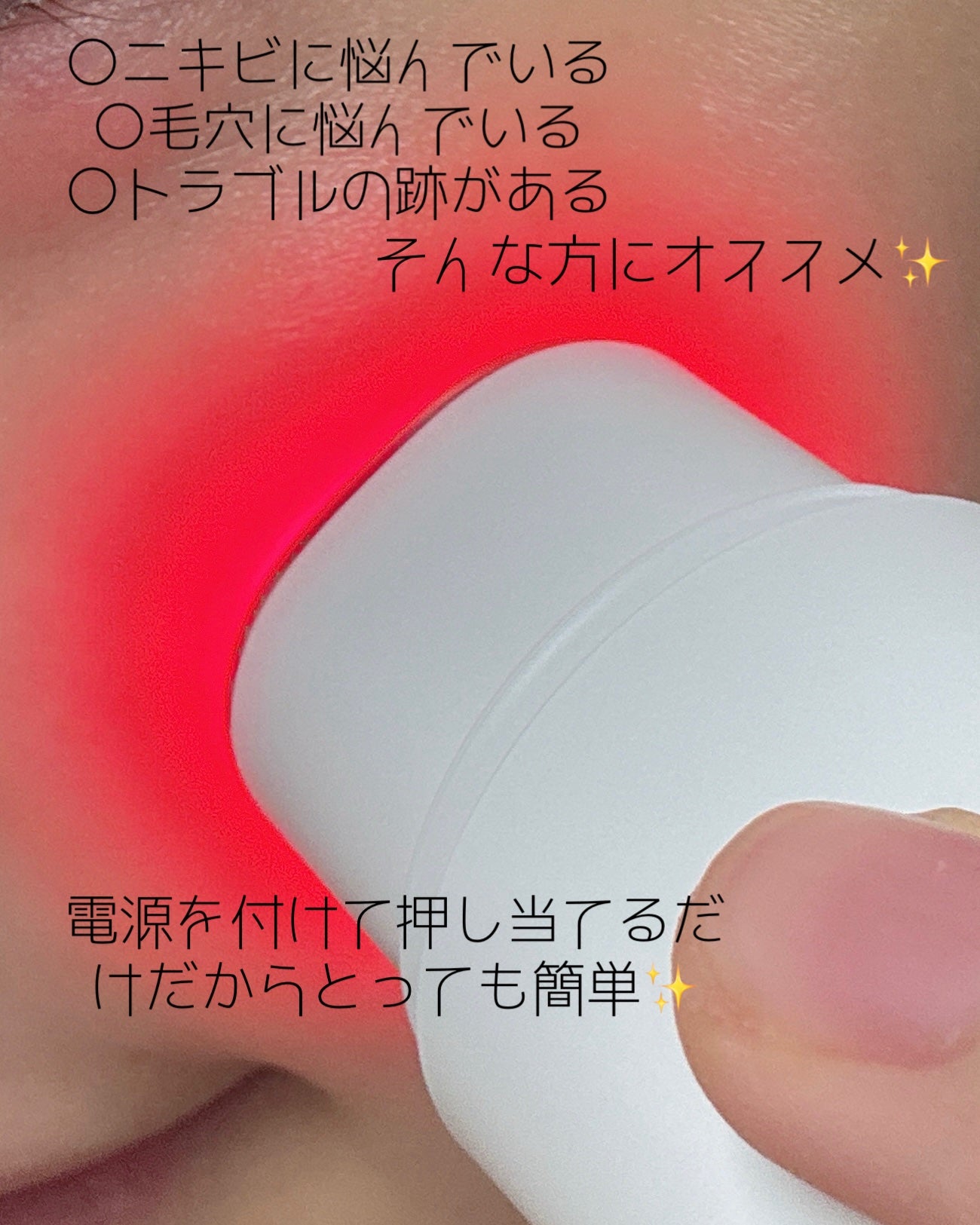 NMN-PDRN ダーマアンサー ポア ファーミング アンプル/CNP Laboratory/美容液を使ったクチコミ(3枚目)