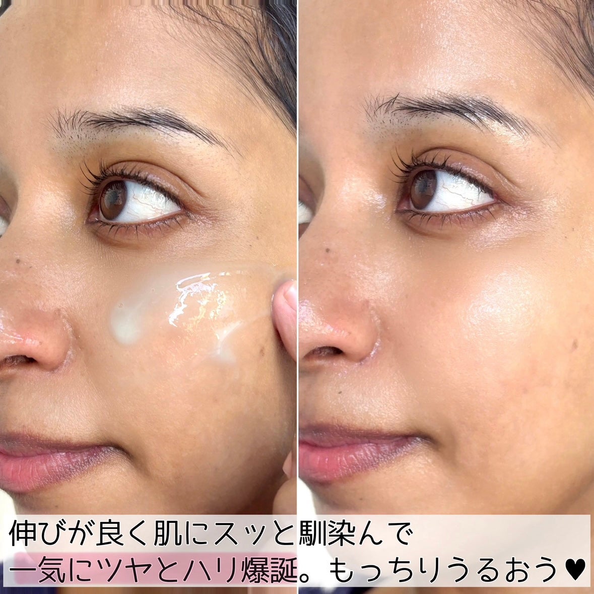 ReDRNエクソソームアンプル/Dr.nineteen/美容液を使ったクチコミ(5枚目)