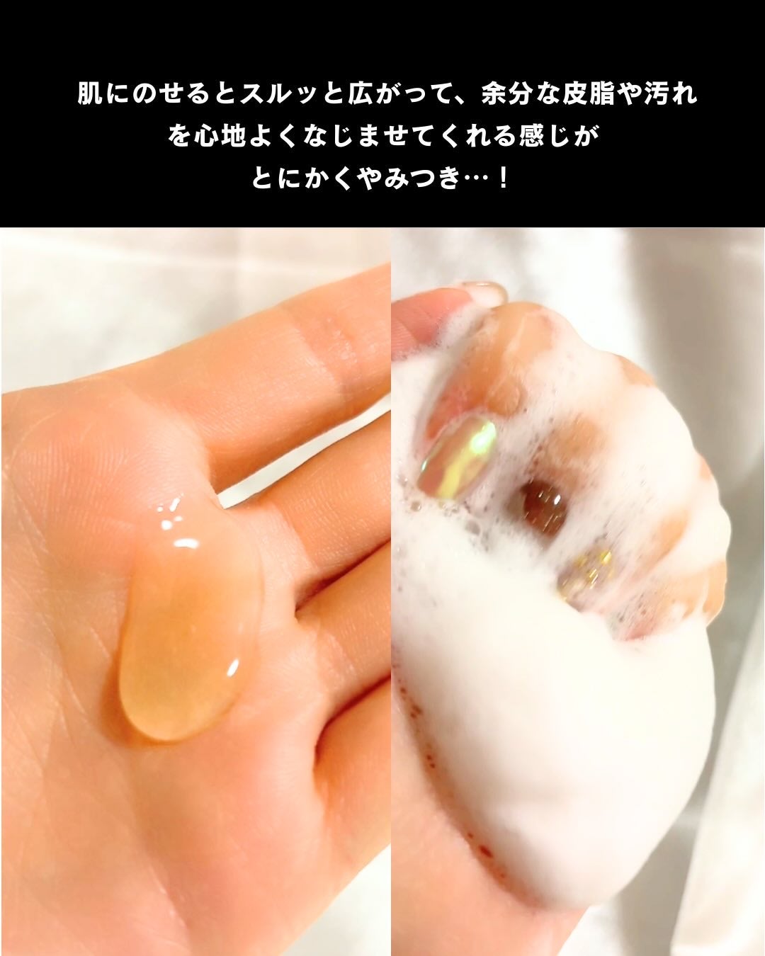 ベルプリモ ACジェルクレンザー/BELPRIMO/洗顔フォームを使ったクチコミ(3枚目)