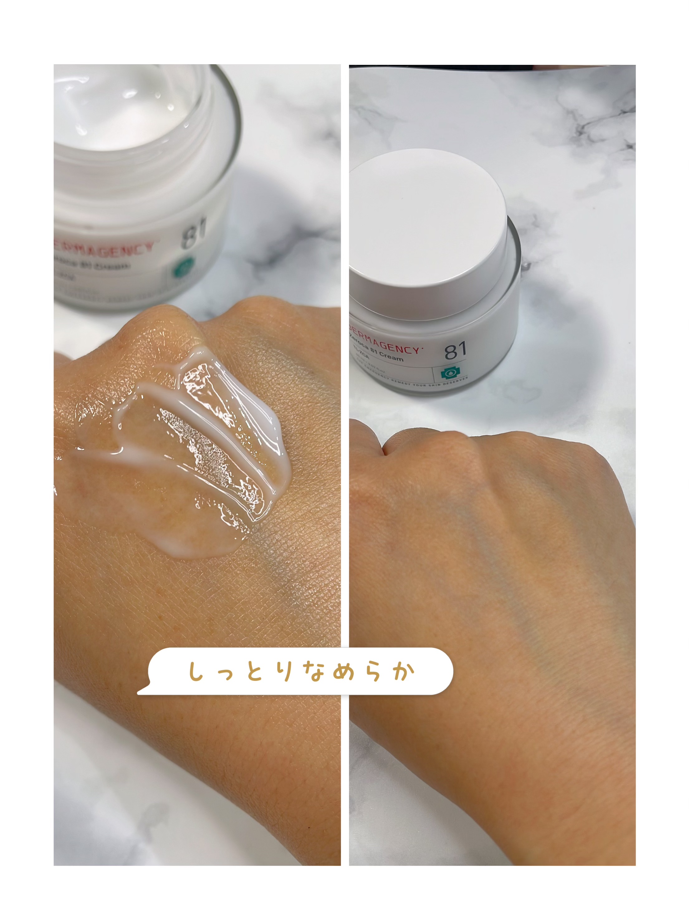 ダーマジェンシー ゼロカ81 クリーム/DERMAGENCY/フェイスクリームを使ったクチコミ（3枚目）