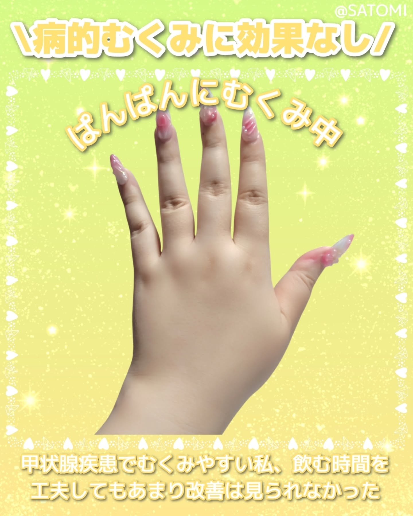 キレートレモンMUKUMI/Pokka Sapporo (ポッカサッポロ)/美容ドリンクを使ったクチコミ（3枚目）