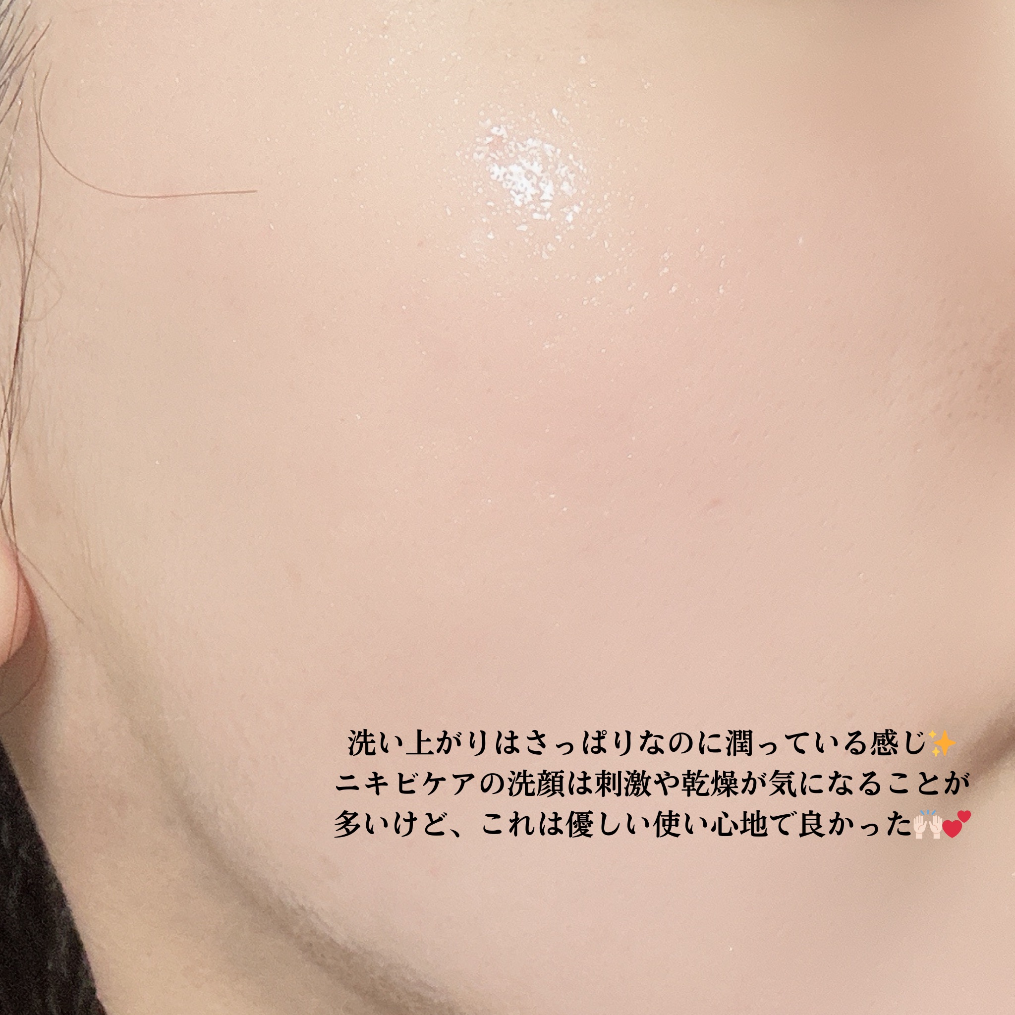 ベルプリモ ACジェルクレンザー/BELPRIMO/洗顔フォームを使ったクチコミ（3枚目）