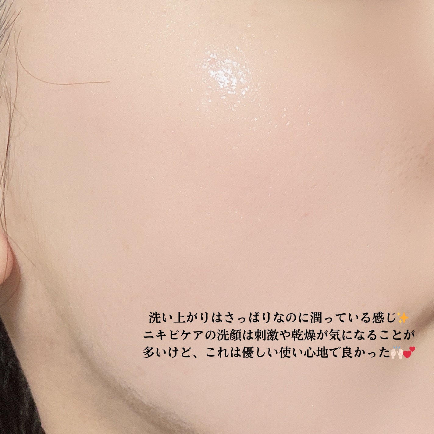 ベルプリモ ACジェルクレンザー/BELPRIMO/洗顔フォームを使ったクチコミ(3枚目)