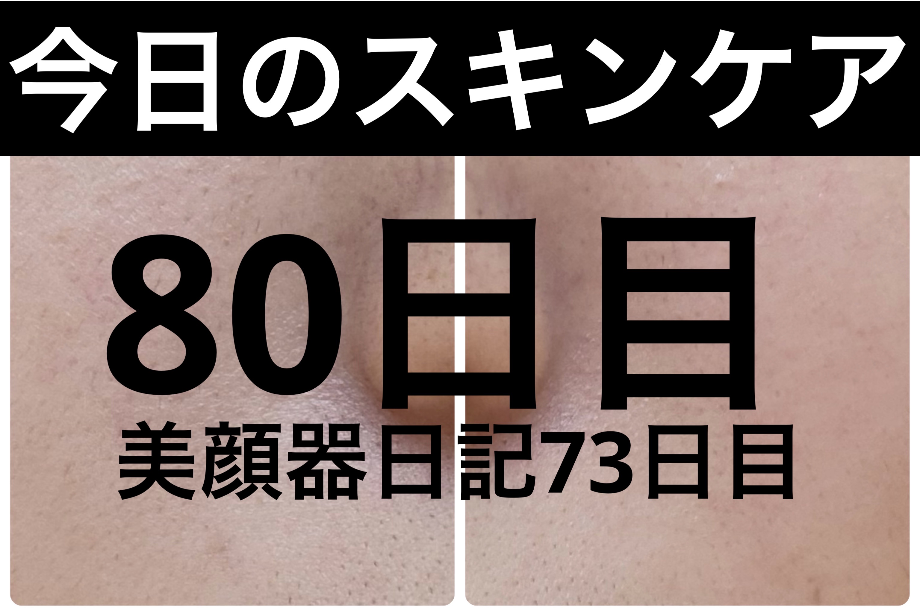 モーニングジェルウォッシュ/ビトレスキン/その他洗顔料を使ったクチコミ（1枚目）