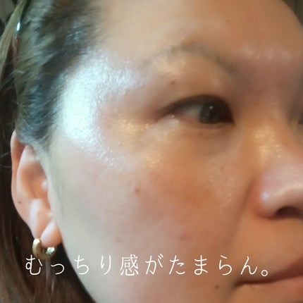 ReDRNエクソソームアンプル/Dr.nineteen/美容液を使ったクチコミ(4枚目)