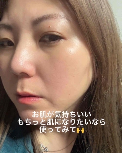 sakura on LIPS 「季節の変わり目のスキンケアにもおすすめ‼️Dr.ninetee..」(4枚目)