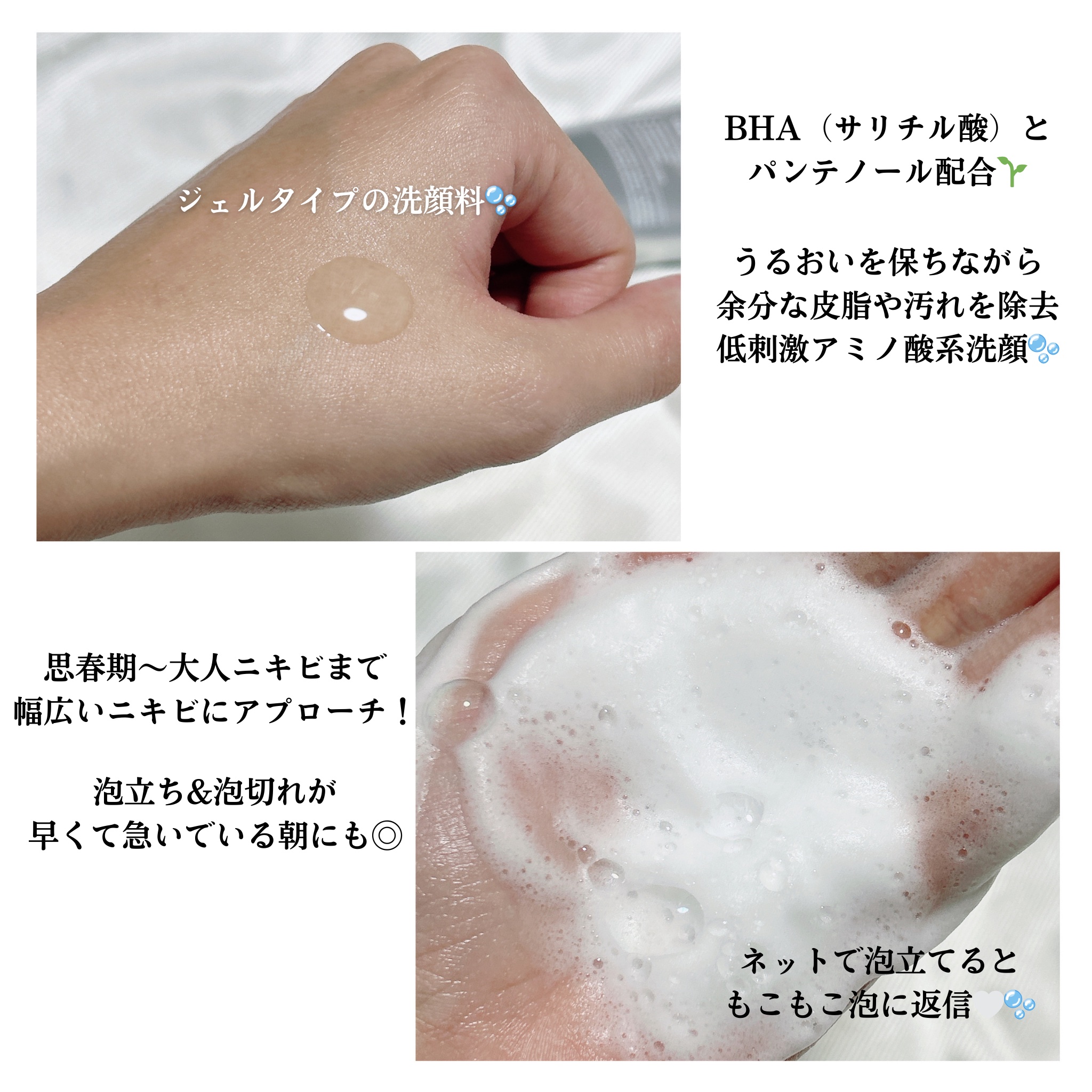 ベルプリモ ACジェルクレンザー/BELPRIMO/洗顔フォームを使ったクチコミ（2枚目）