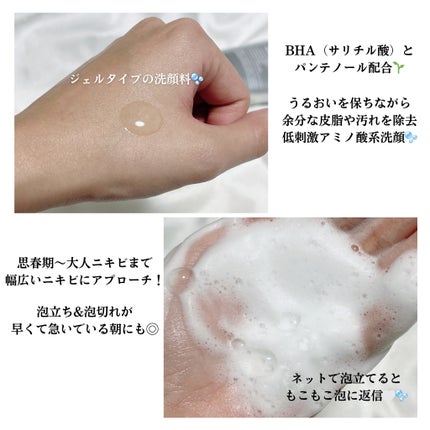 ベルプリモ ACジェルクレンザー/BELPRIMO/洗顔フォームを使ったクチコミ(2枚目)