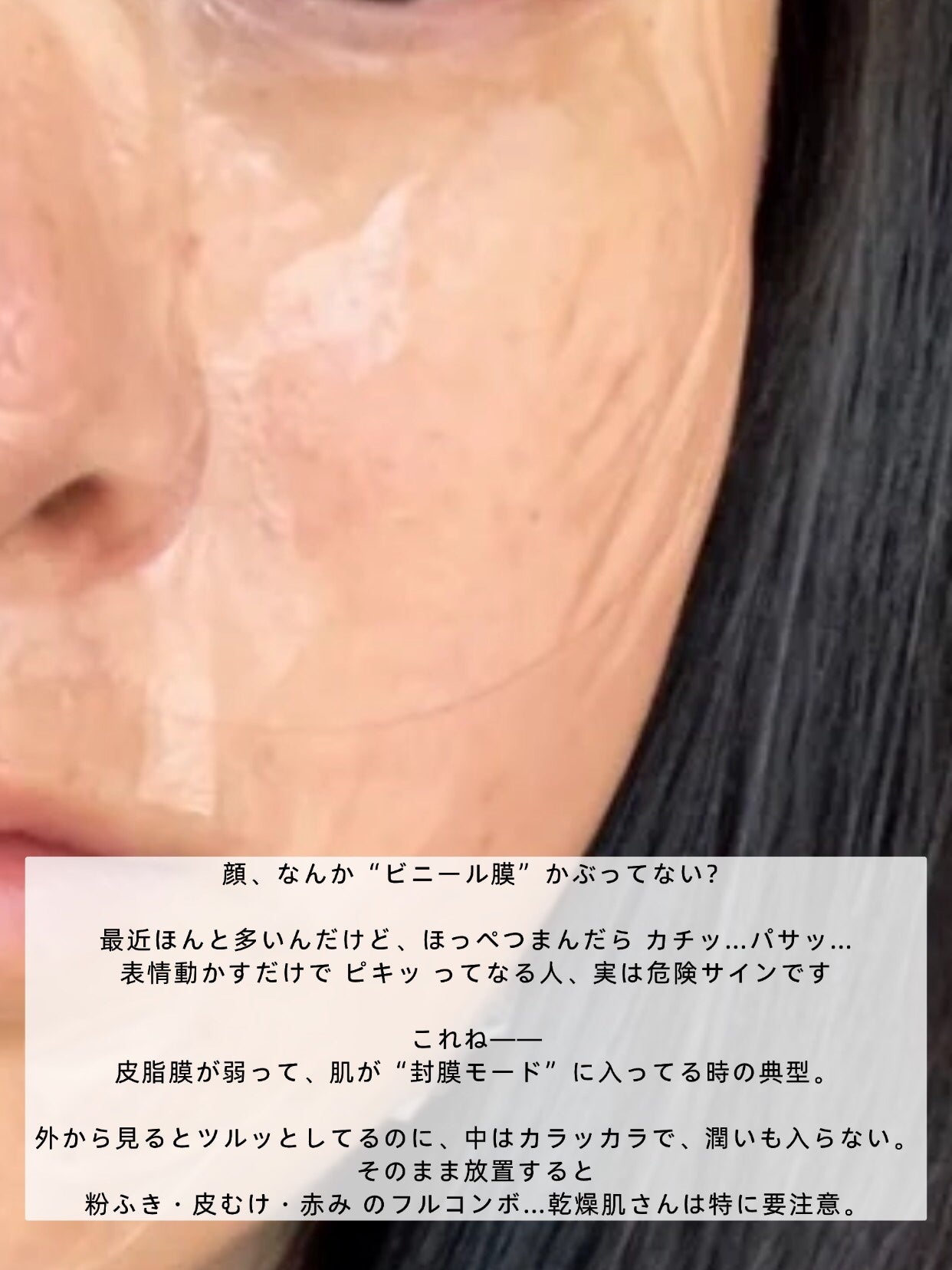 アネトス バランシング トリートメントクリーム/Anetos/フェイスクリームを使ったクチコミ(2枚目)