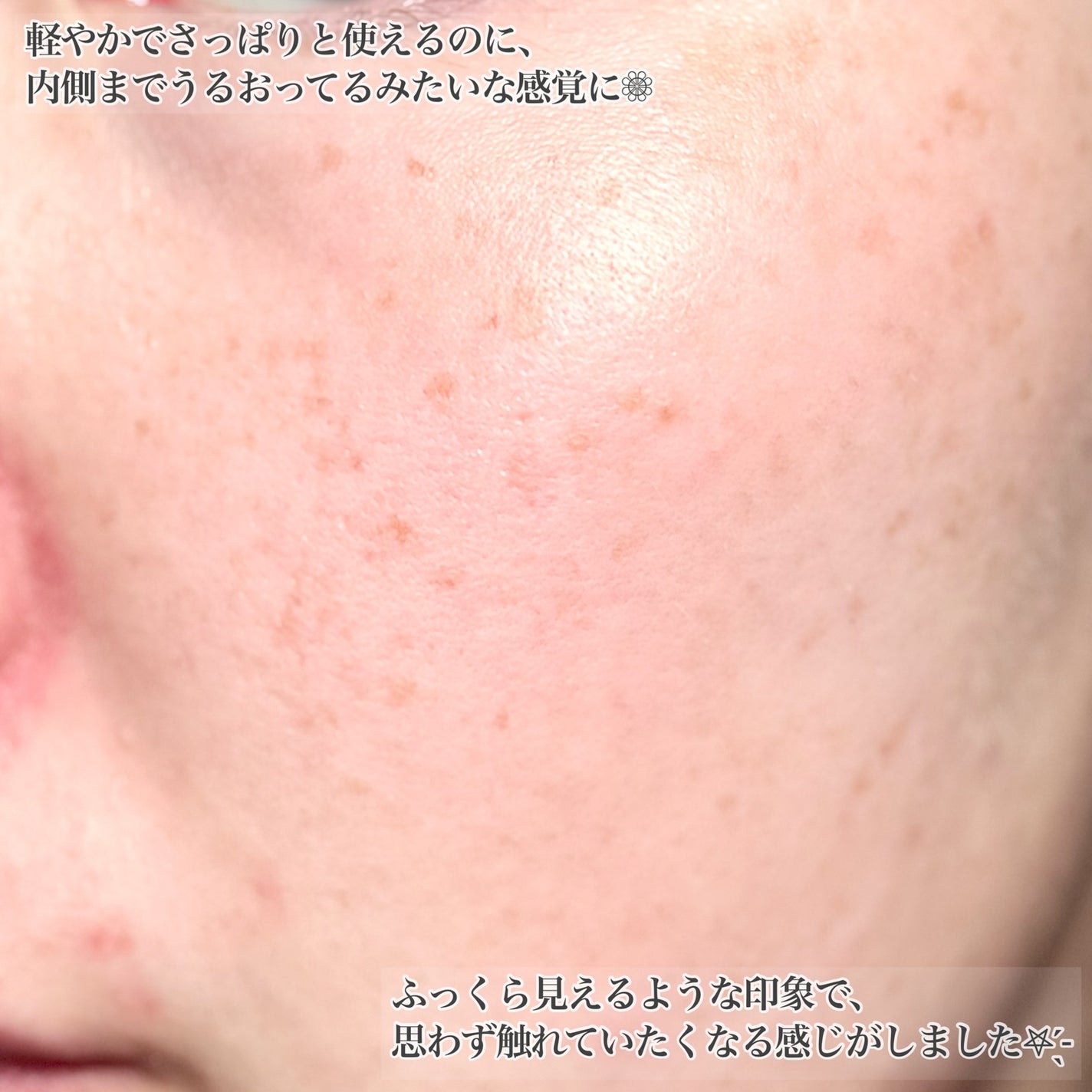 リラックス シカ アクア トナー/LAIEL/化粧水を使ったクチコミ(5枚目)