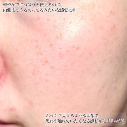 リラックス シカ アクア トナー/LAIEL/化粧水を使ったクチコミ(5枚目)