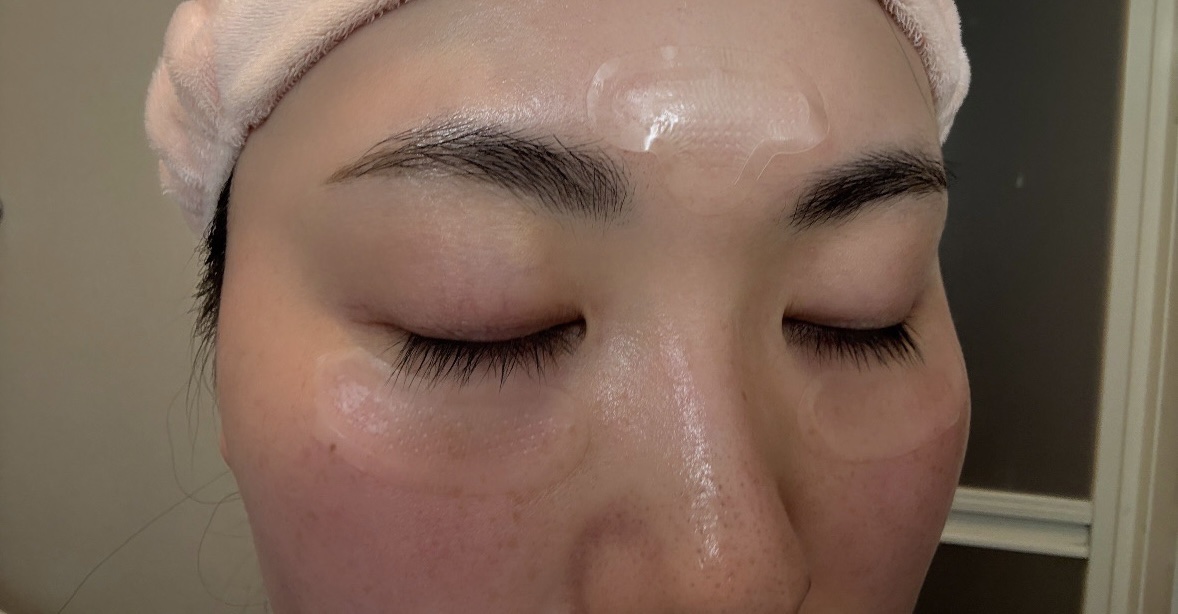 レチアールエヌ スリムパッチ/ACROPASS/シートマスク・パックを使ったクチコミ（3枚目）