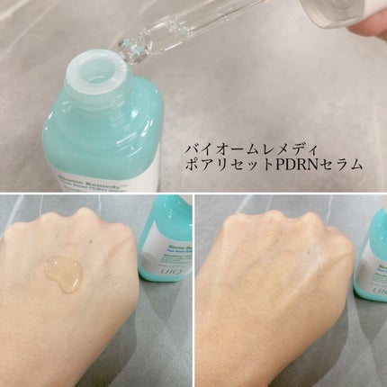 バイオームレメディポアリセットPDRN セラム/UIQ/美容液を使ったクチコミ(3枚目)