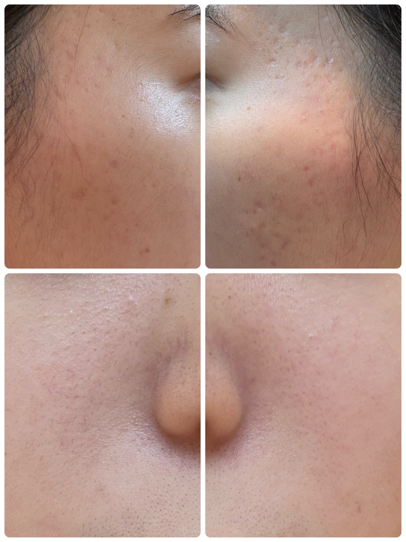 モーニングジェルウォッシュ/ビトレスキン/その他洗顔料を使ったクチコミ(2枚目)