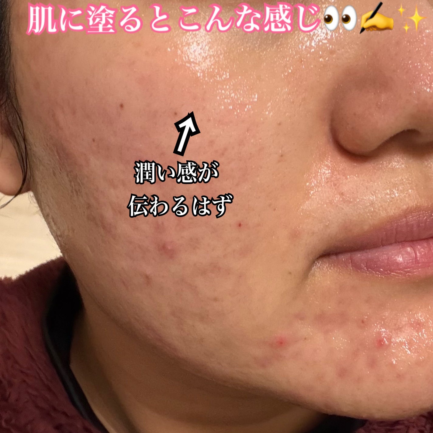 ベルプリモ ACコンフォートエッセンス/BELPRIMO/美容液を使ったクチコミ(3枚目)